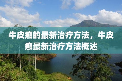 牛皮癬的最新治療方法，牛皮癬最新治療方法概述
